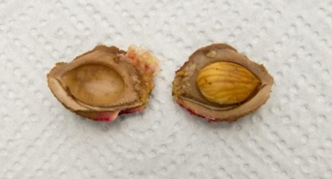 Jak množit třešňovou švestku se semeny, řízky a vrstvením doma